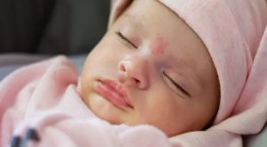 Doğum lekeleri neden oluşur?