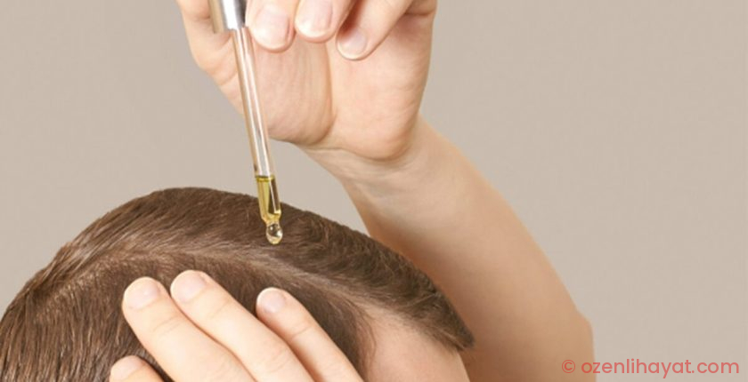 Saç dökülmesine doğal çözüm! İşte mucizevi etki yaratan 10 yağ Saç dökülmesine doğal çözüm! İşte mucizevi etki yaratan 10 yağ