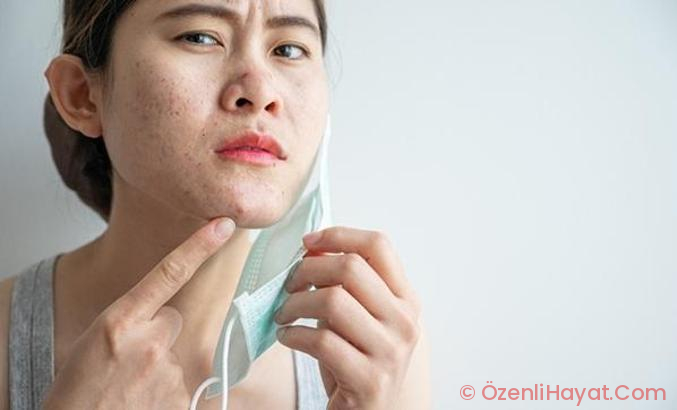 3 bakım ipucu kışın ipeksi pürüzsüz bir cilt vaat ediyor