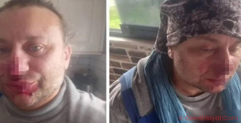 Ağır bakımdan çıkan Onur Akay pitbull dehşetini anlattı: ‘Ölümden döndüm’
