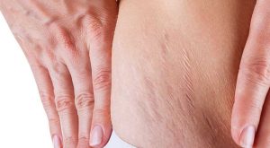 Bedenimizdeki çatlaklarla savaşmanın kolay yolu