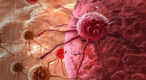 Bedeninizin sessiz ihtarları: Kanser öncesi belirtileri göz gerisi etmeyin!