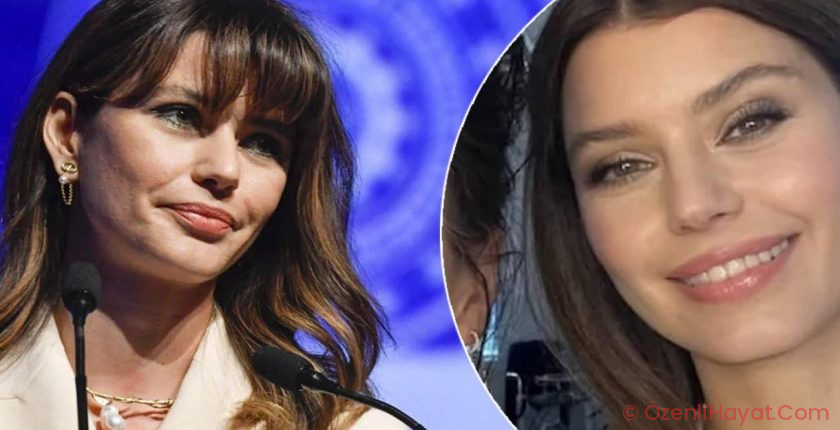 Beren Saat’in son imajı ‘estetik’ tezlerini alevlendirdi!