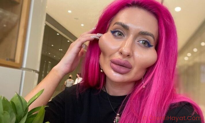 Dünyanın en büyük yanaklı kadını!