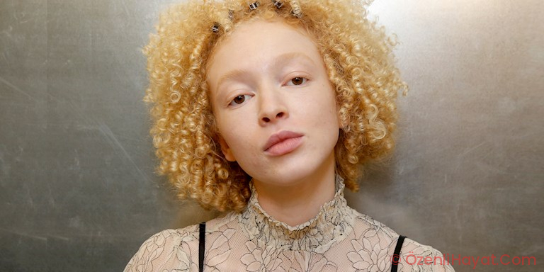 ELVEDA SİYAH NOKTALAR!