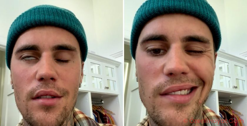 Justin Bieber, yüz felci hastalığıyla ilgili son durumunu paylaştı
