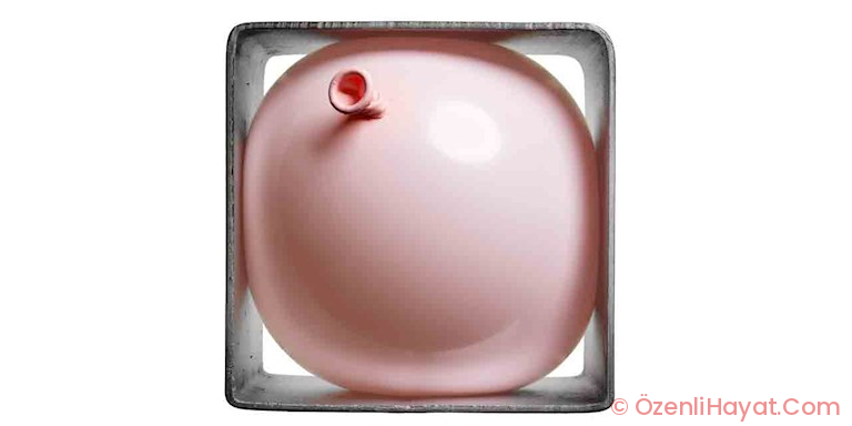 MİDE BOTOKSU MU DEDİNİZ?