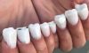 Protez tırnak ve nail arka sevdalılarını çıldırtacak rezalet ötesi 10 takma tırnak modeli