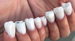 Protez tırnak ve nail arka sevdalılarını çıldırtacak rezalet ötesi 10 takma tırnak modeli