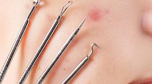 Siyah noktalarınızdan büsbütün kurtulabilirsiniz