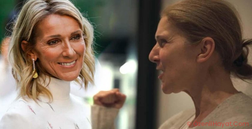 Tedavisi olmayan ender hastalıkla gayret ediyor: Celine Dion yıllar sonra sahnelere dönecek!