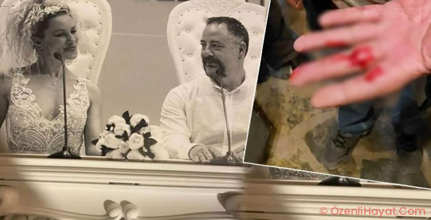 Yıldız Asyalı’nın eş kabusu büyüyor: Babamı da darp etti!