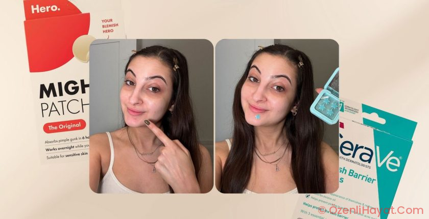 6 Best Pimple Patches for Every Type of Breakout