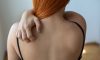 6 Things Doctors Wish You Knew About Shingles 6 Things Doctors Wish You Knew About Shingles