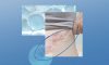 How to Prevent Long-Term Skin Damage from Shingles How to Prevent Long-Term Skin Damage from Shingles