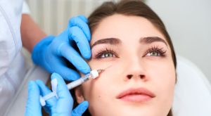 I Tried PRF Fillers for My 30th Birthday—Here’s What I Wish I’d Known First