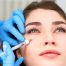 I Tried PRF Fillers for My 30th Birthday—Here’s What I Wish I’d Known First