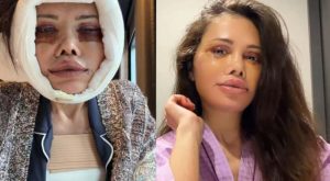 Kore’de yüz nakli geçirmişti! Didem Ceran’ın yüzü ile ilgili sorduğu soru gündem oldu