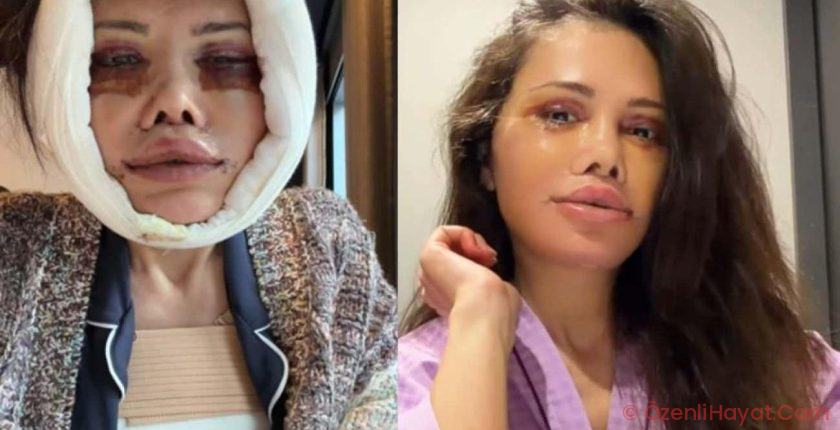 Kore’de yüz nakli geçirmişti! Didem Ceran’ın yüzü ile ilgili sorduğu soru gündem oldu
