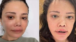 Yüz nakli olan Didem Ceran’ın gençlik sırrı yumurta çıktı!