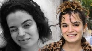 Aslı Bekiroğlu’ndan nazar isyanı: “Düz yolda düştüm kaslarım yırtık!”