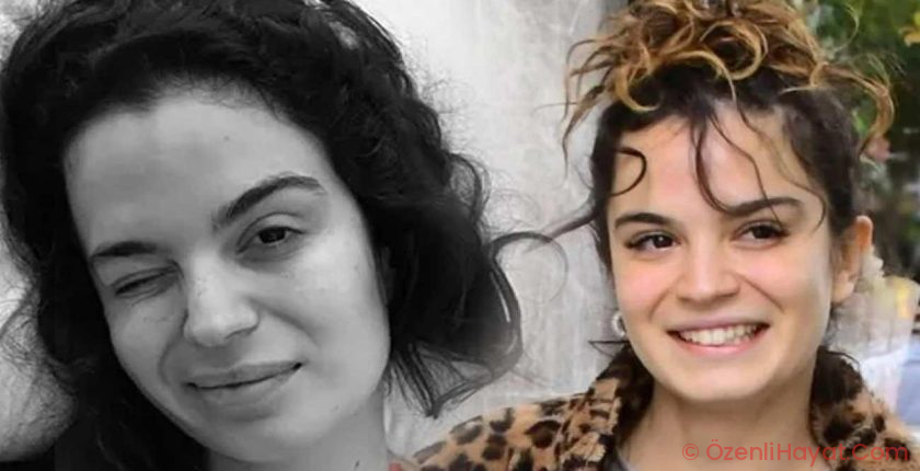 Aslı Bekiroğlu’ndan nazar isyanı: “Düz yolda düştüm kaslarım yırtık!”