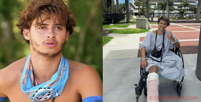 Bacağı ampute edilmişti! Survivor yarışmacısının son hali ortaya çıktı